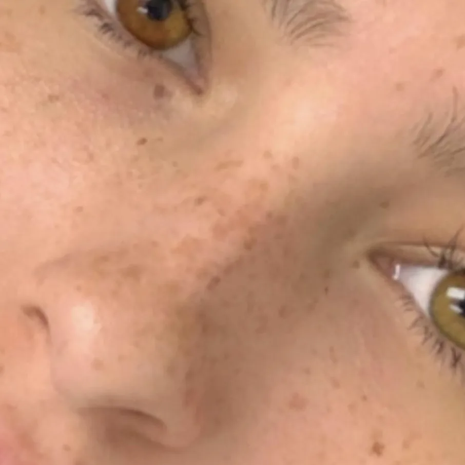 Taches de rousseur naturelles tatouage